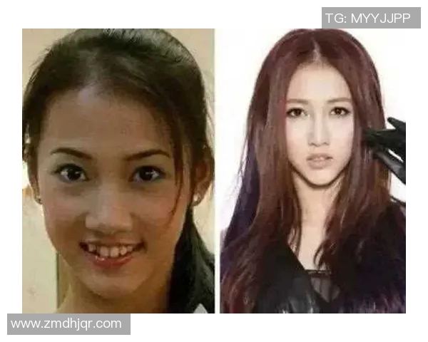 足球球星换牙事件揭秘 从牙齿到笑容的背后故事 足球球星换牙事件揭秘 从牙齿到笑容的背后故事